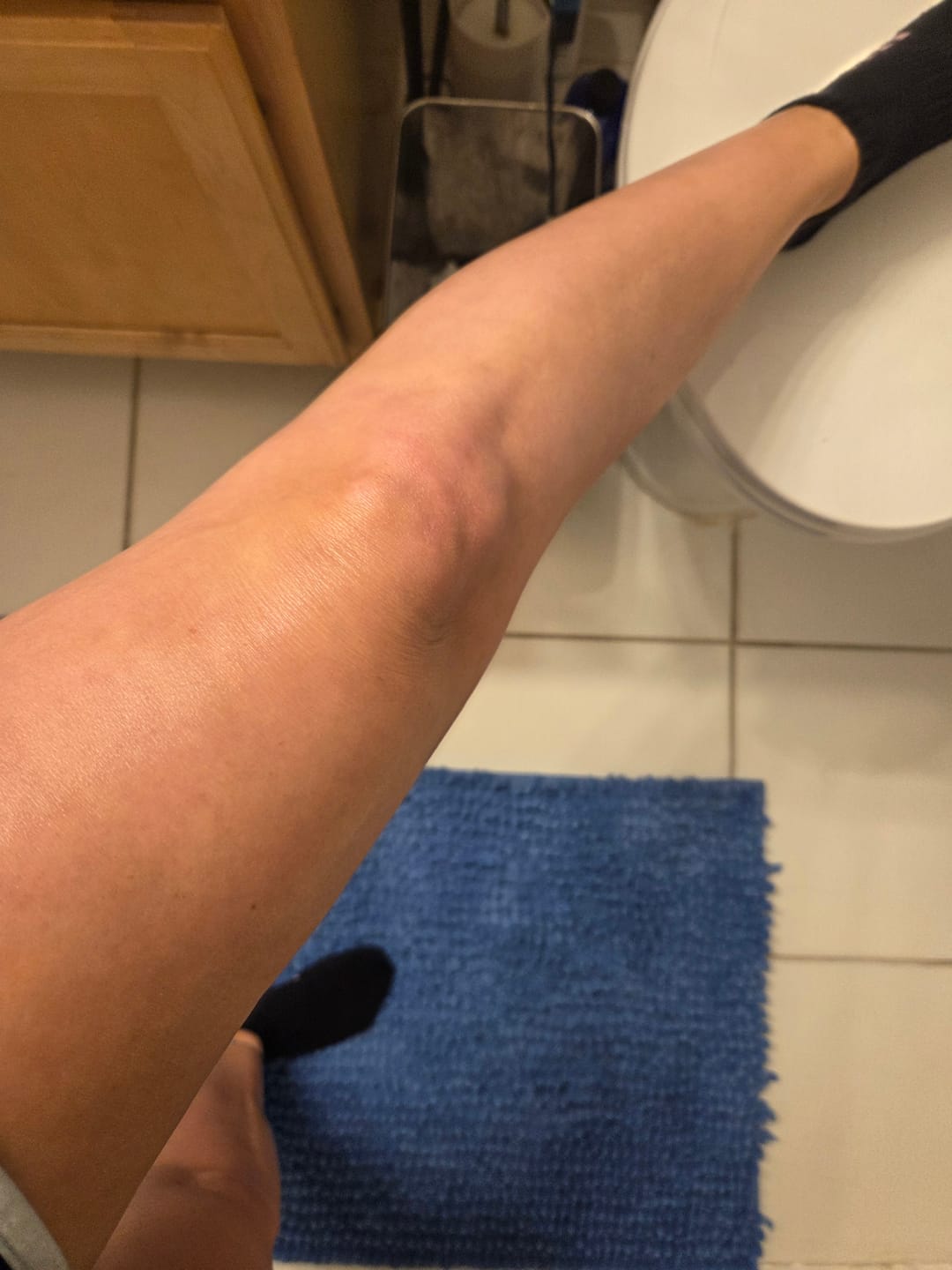 Customer photo review of Botanical Body Oil™