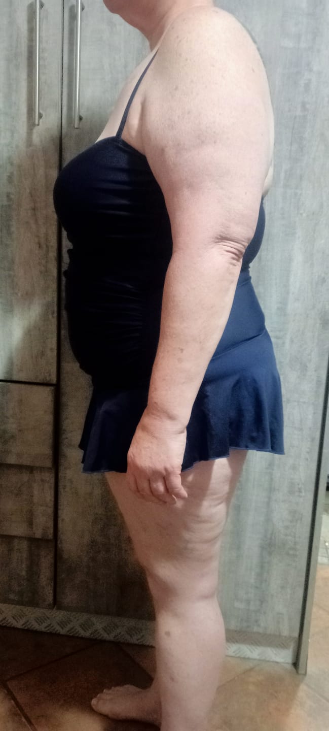 Customer photo review of CheetaThin® Weight Management - Buy 2 Get 2 Free, Free Access to Exit Plan + Win R5,000 Challenge