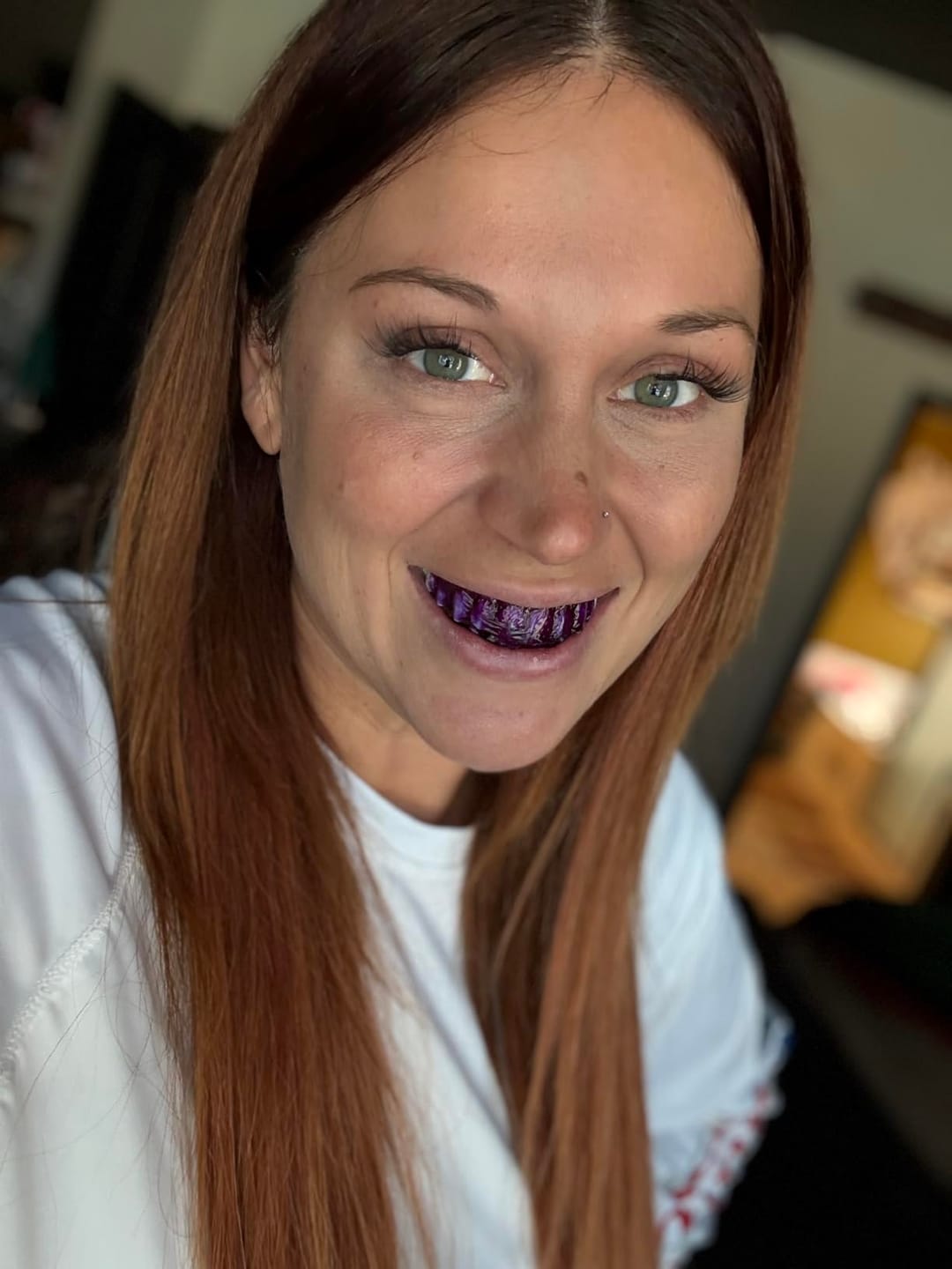 Customer photo review of Toothly™ Peptide Whitening Strips (For Sensitive Teeth)