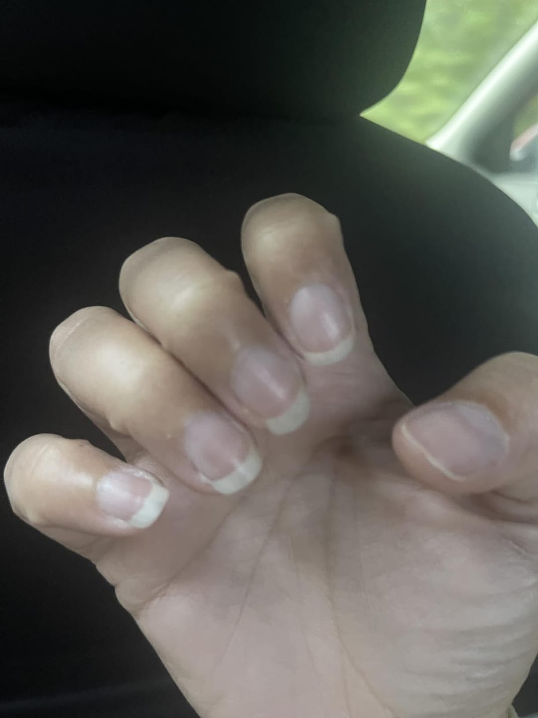 Customer photo review of Cabello.Piel.Uñas