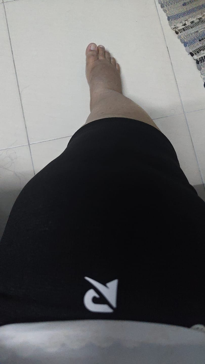 Customer photo review of Recovry™ V2 Kneesleeve