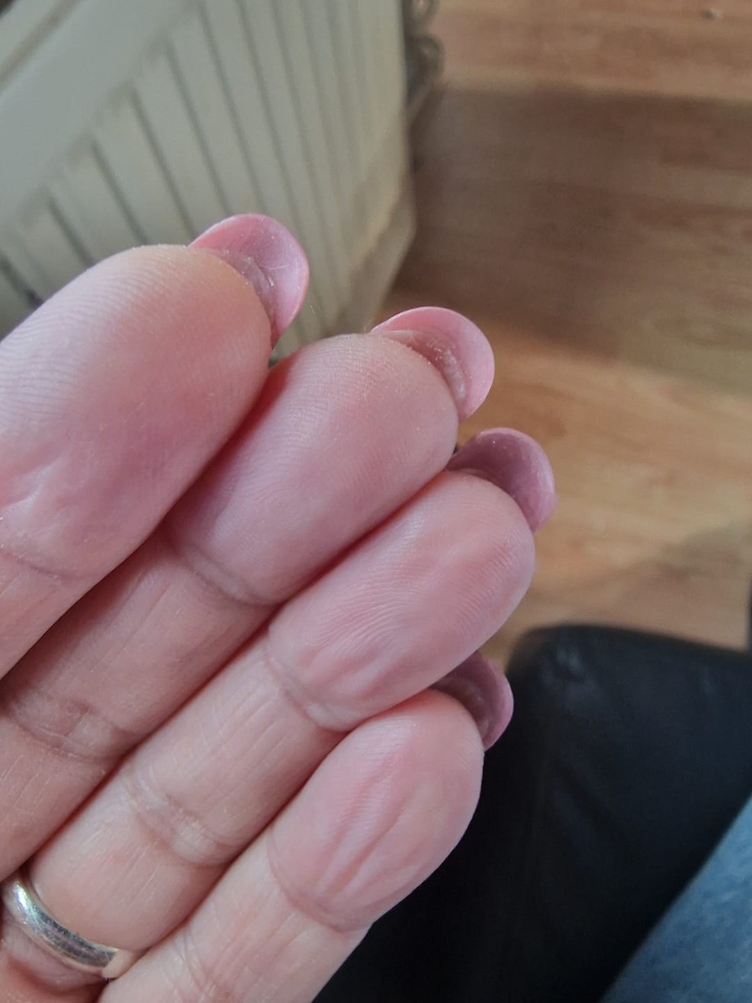 Customer photo review of Fake Tips - Hele Tips