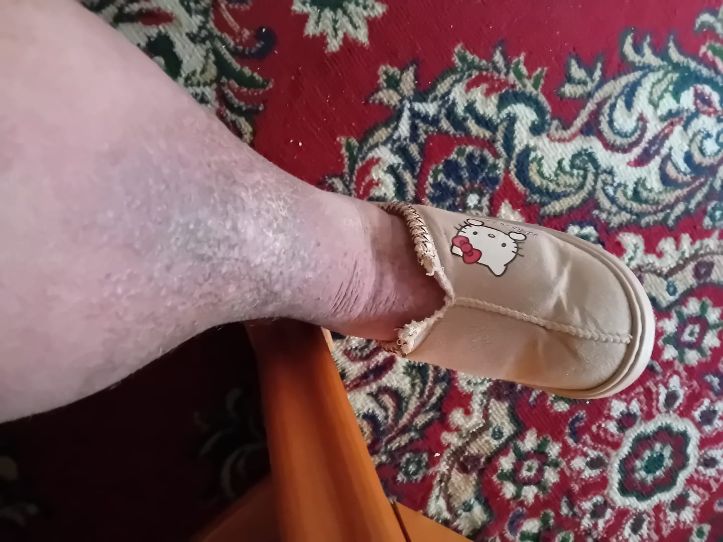 Customer photo review of Duftstofffreie, nicht fettende Anti-Juckreiz-Lotion mit Ceramid NP für trockene, gerötete und empfindliche Haut