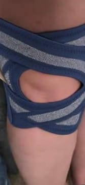 Customer photo review of Open-Knee Brace for Achy, Unsteady Knees