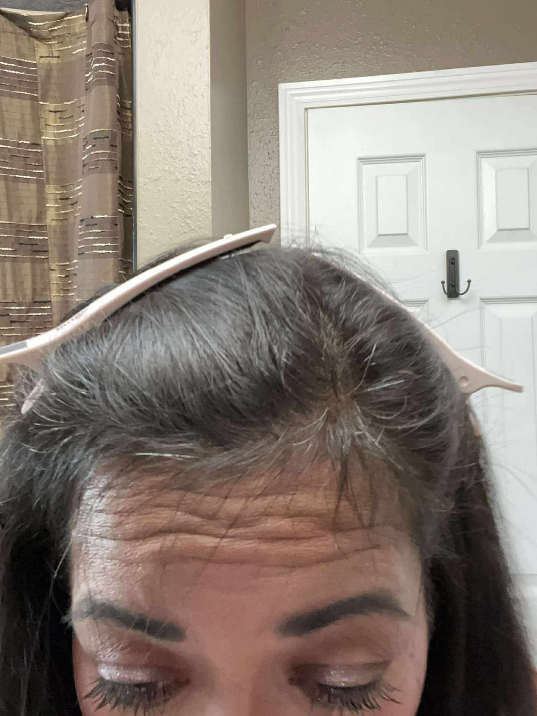 Customer photo review of Hair Growth Serum