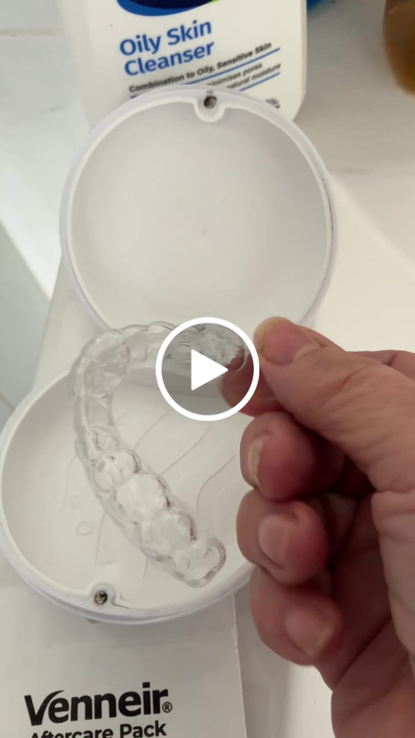 Customer video review of Essix Retainers