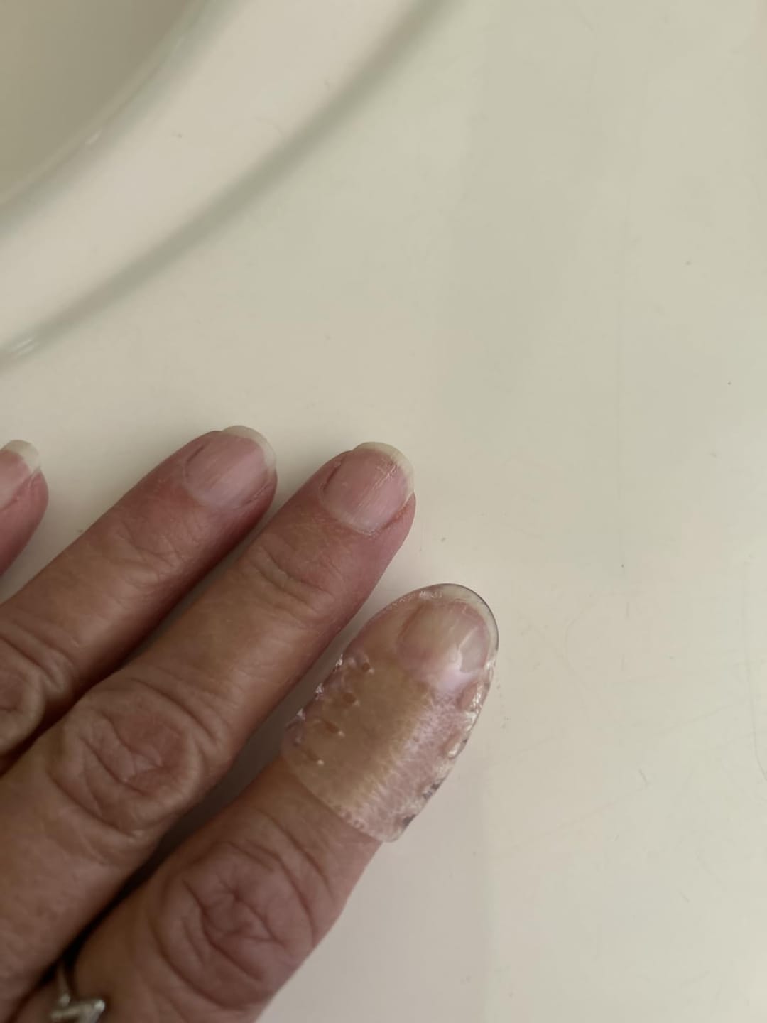 Customer photo review of ANTI-CHAFE TOE SLEEVES