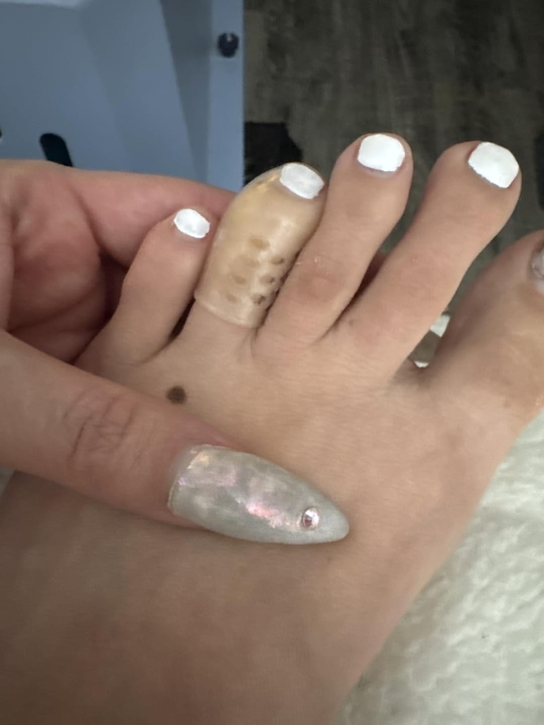 Customer photo review of ANTI-CHAFE TOE SLEEVES