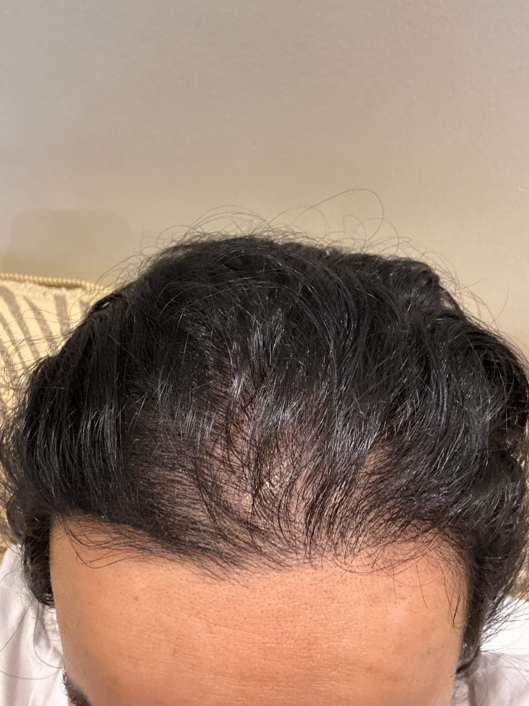 Customer photo review of VITAFOAM™ + Complex10™ Routine Kit