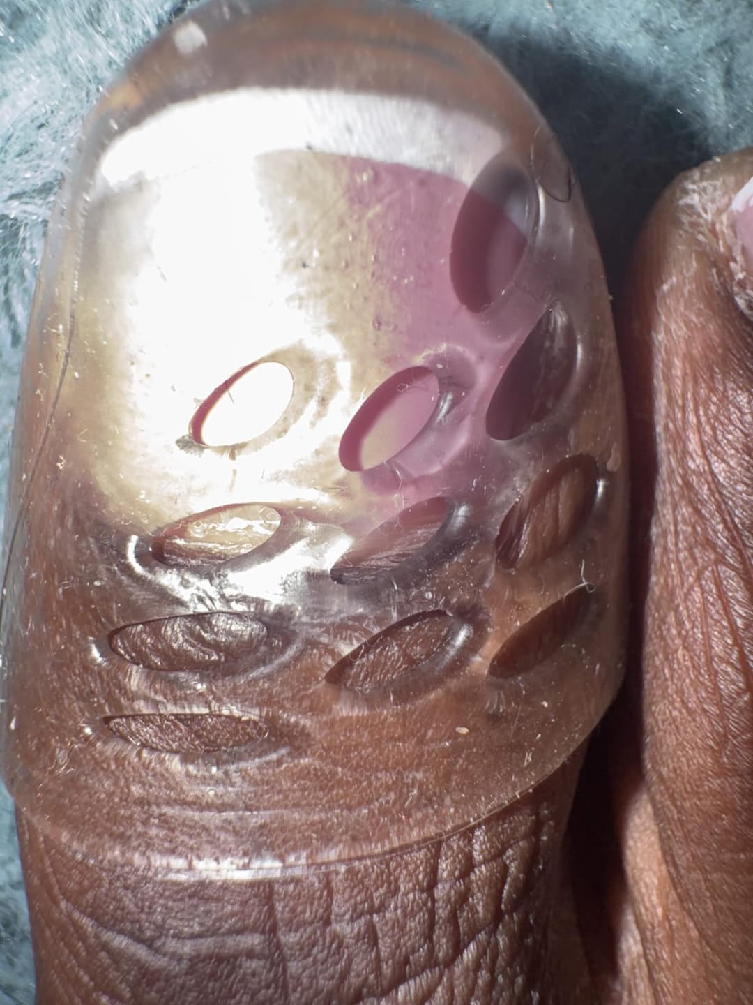 Customer photo review of ANTI-CHAFE TOE SLEEVES