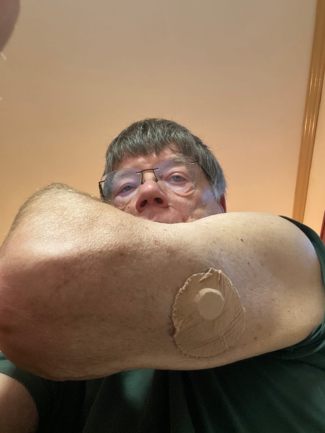 Customer photo review of Skin Grip Original - Freestyle Libre 2+ & Lingo Adhesive Patches