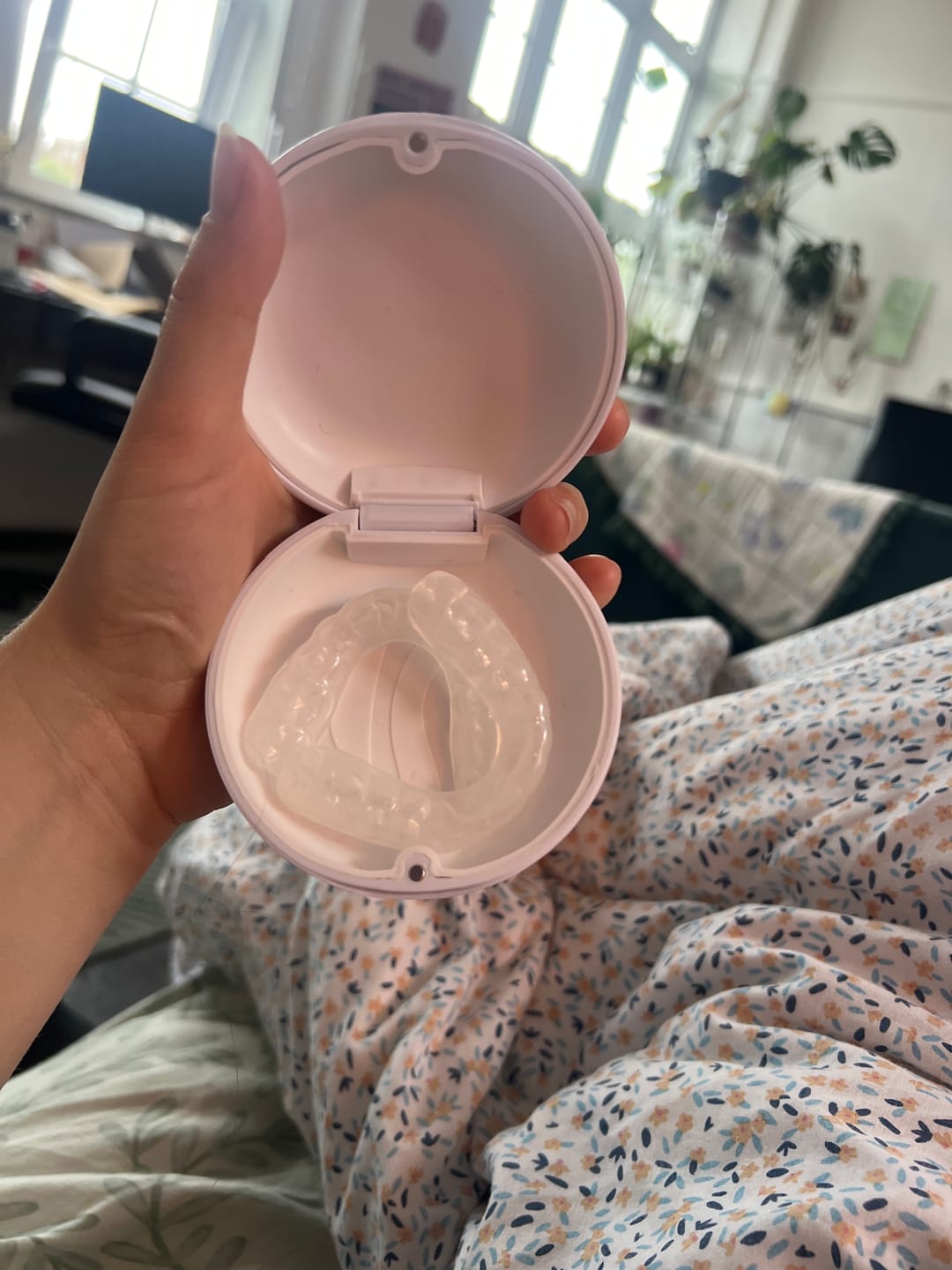 Customer photo review of 3.0mm Soft Night Guards