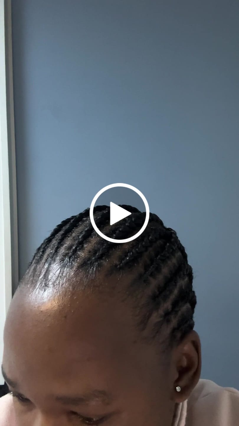 Customer video review of Hair & Hairline Growth Serum Set