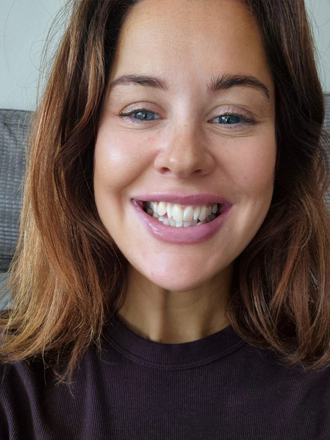 Customer photo review of Peroxide-Free Pro Whitening Kit