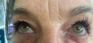 Customer photo review of Purely Lashes Lash Growth Serum