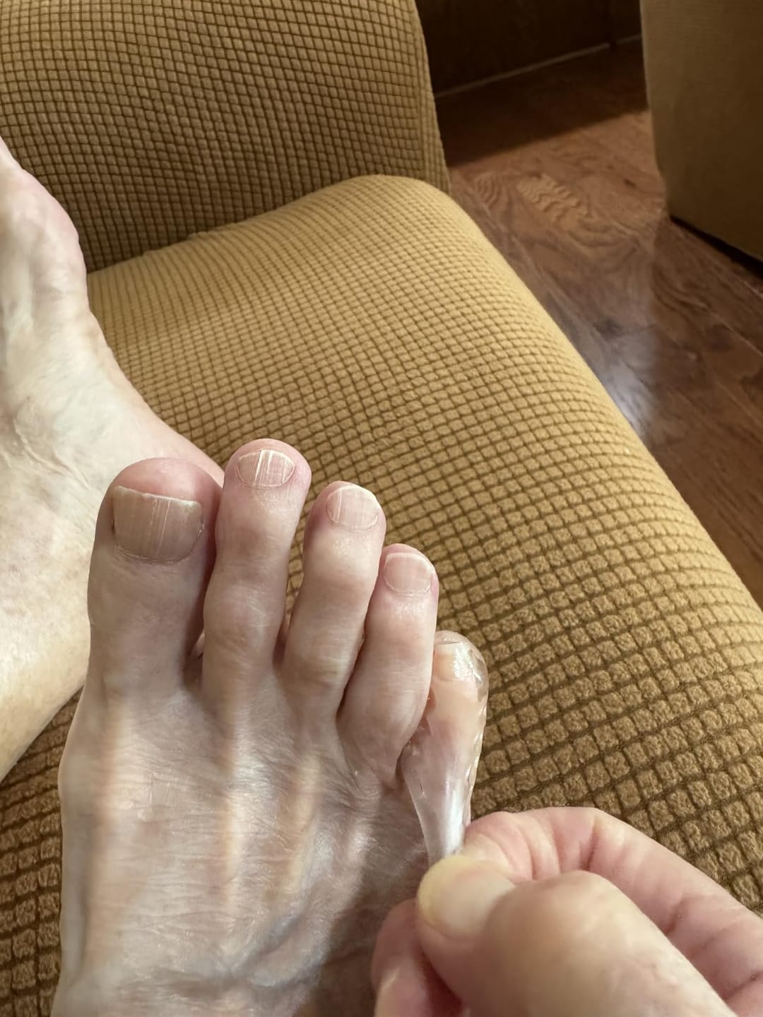 Customer photo review of ANTI-CHAFE TOE SLEEVES