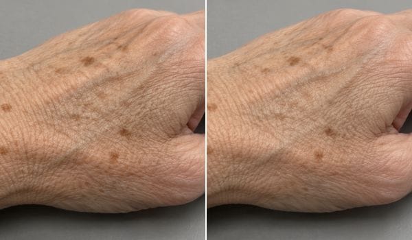 Customer photo review of Hand Renewal Cream