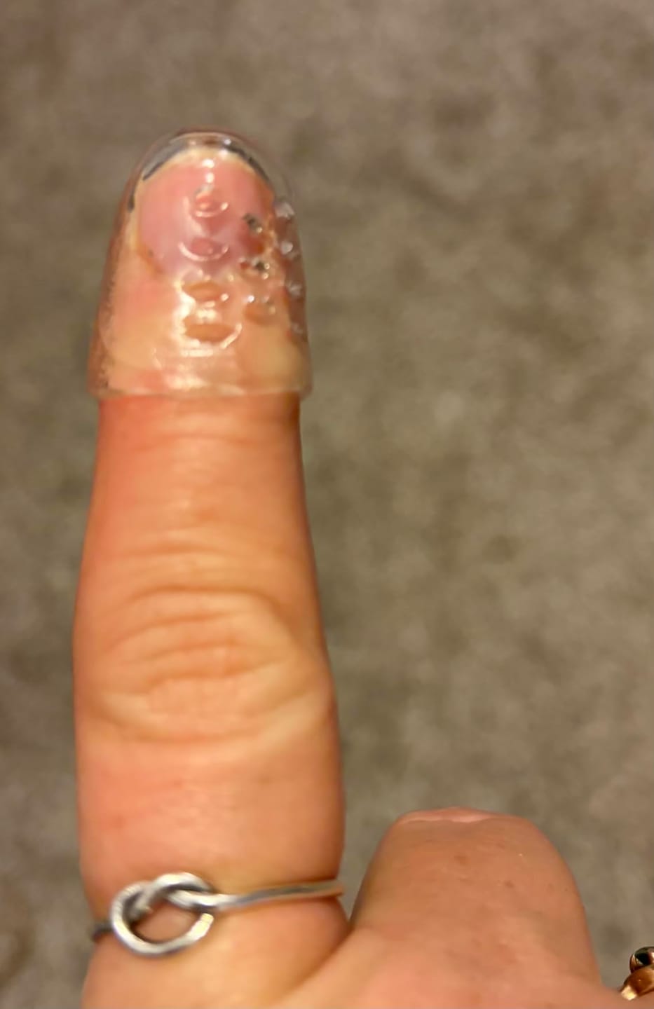 Customer photo review of ANTI-CHAFE TOE SLEEVES