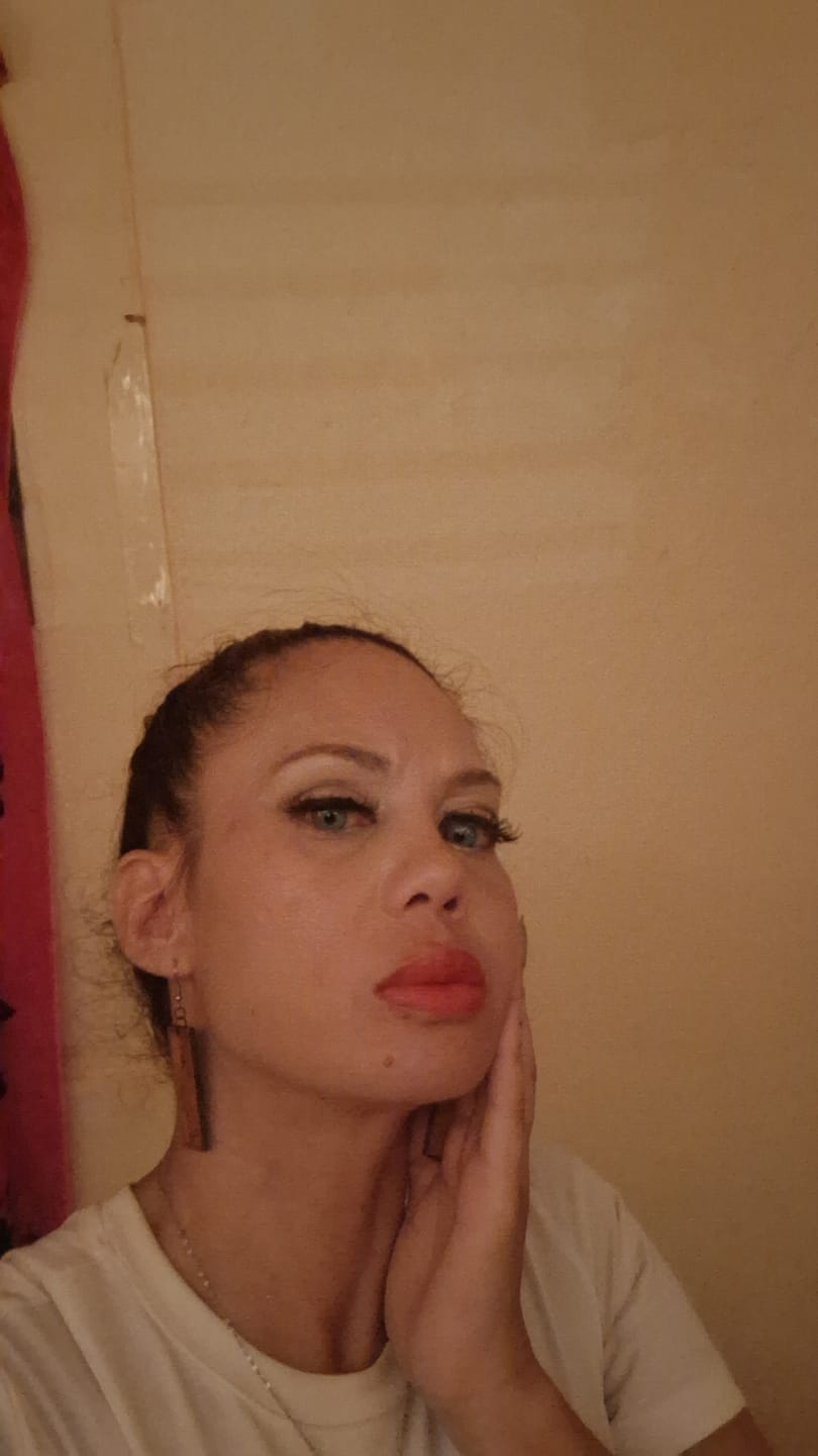 Customer photo review of Amazonia Icy Volcano Gray Prescription Colored Contact Lenses