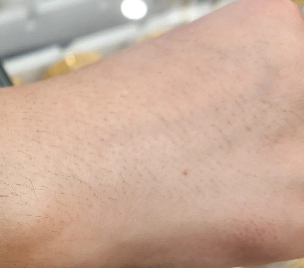 Customer photo review of CLEANBO® ~ Guante Exfoliante Corporal