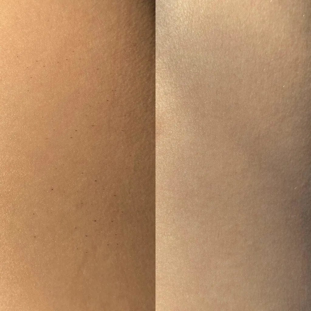 Customer photo review of CLEANBO® ~ Guante Exfoliante Corporal