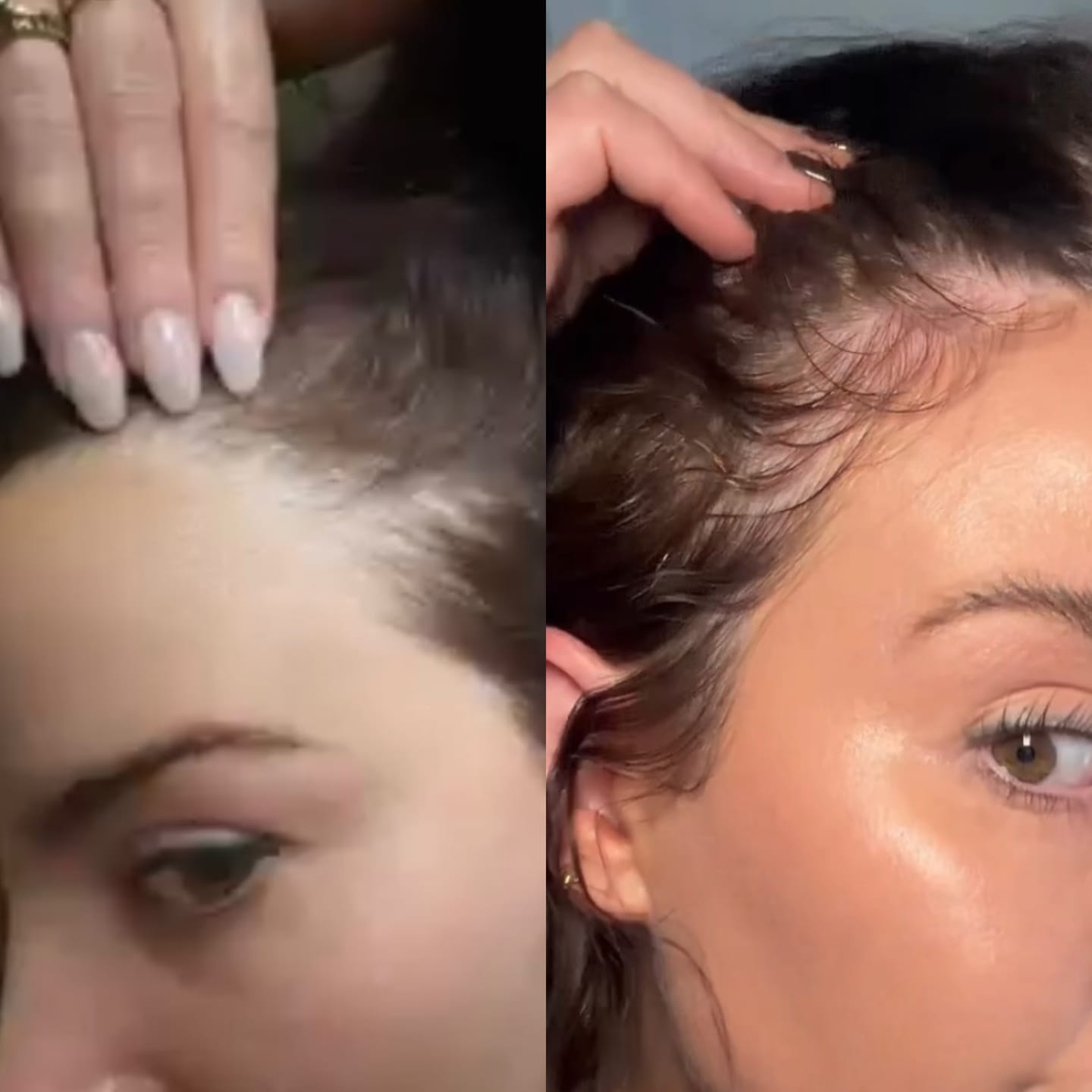 Customer photo review of The Magic Hair Growth Serum with Derma-Roller Applicator - Copper Peptide and Capixyl - Non Greasy Serum