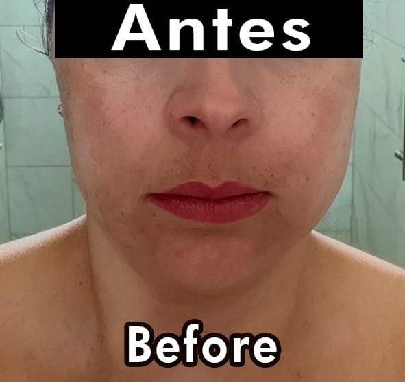 Customer photo review of Lightening illuminating tonic