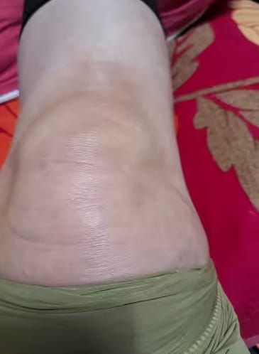 Customer photo review of BeeVita crema para bienestar articular en rodillas, codos y hombros.