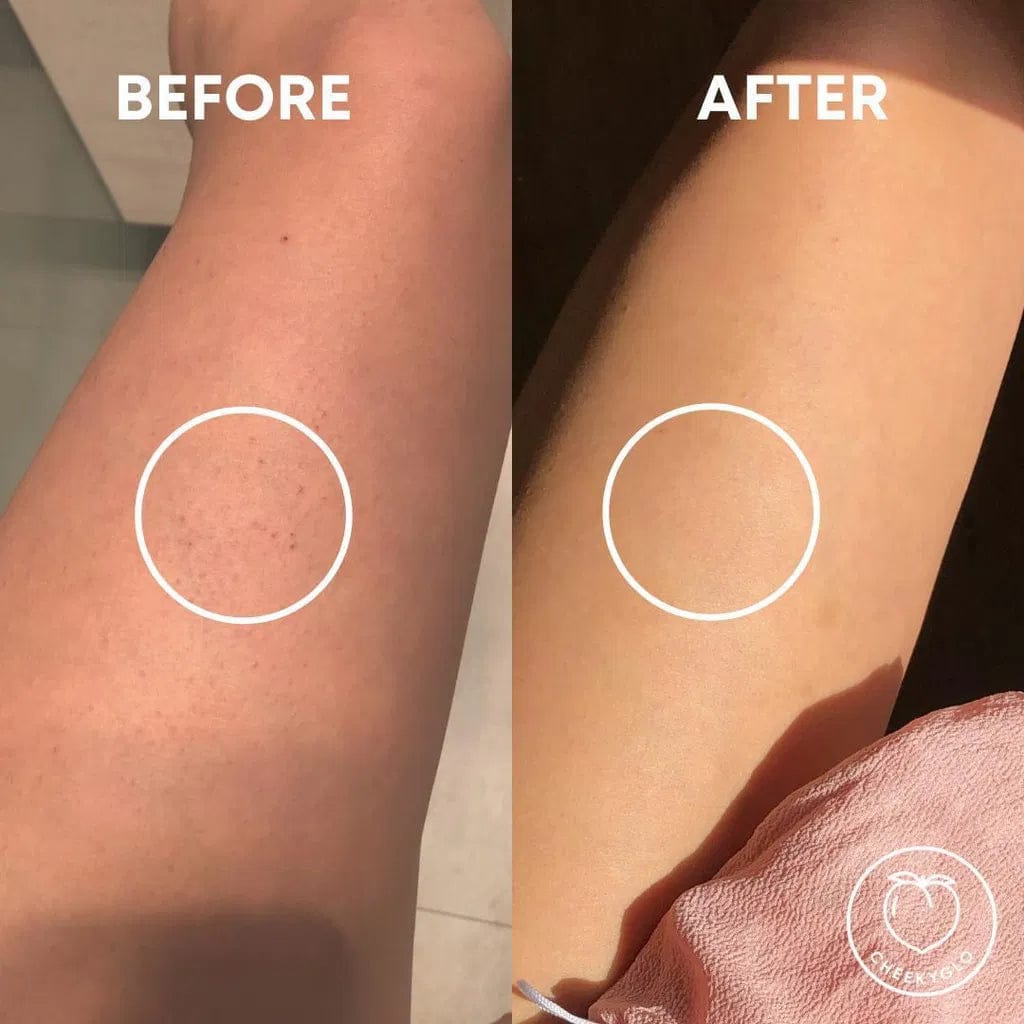 Customer photo review of CLEANBO® ~ Guante Exfoliante Corporal