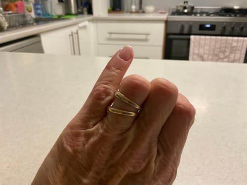 Customer photo review of Nail Guard Bandaid