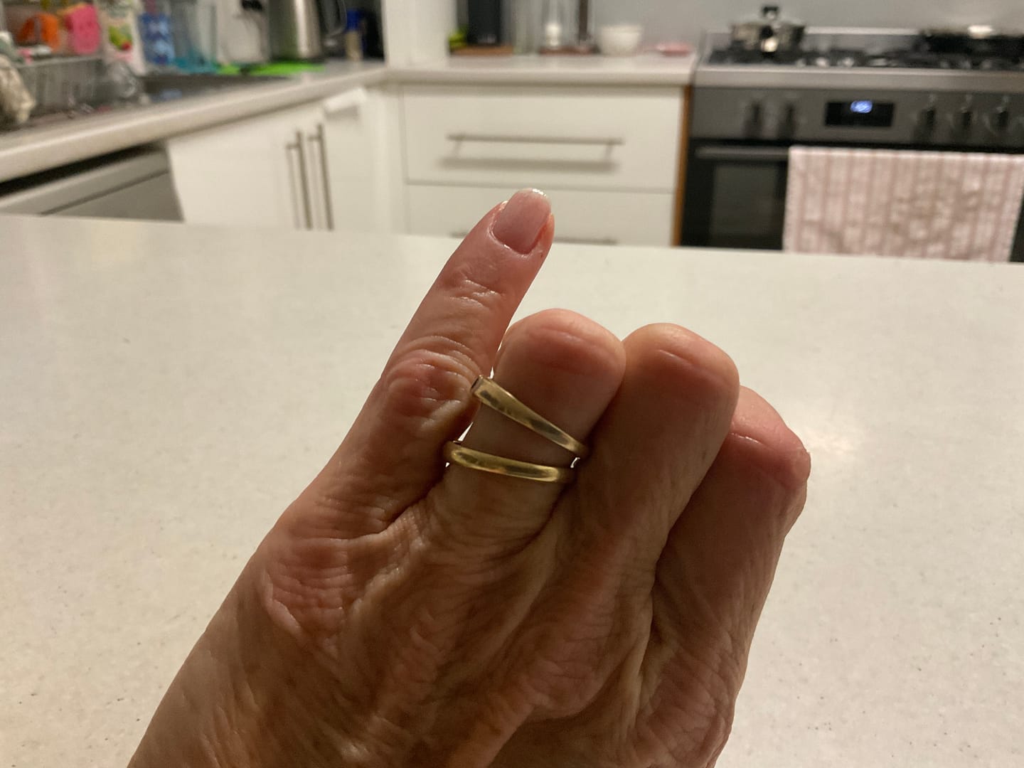 Customer photo review of Nail Guard Bandaid