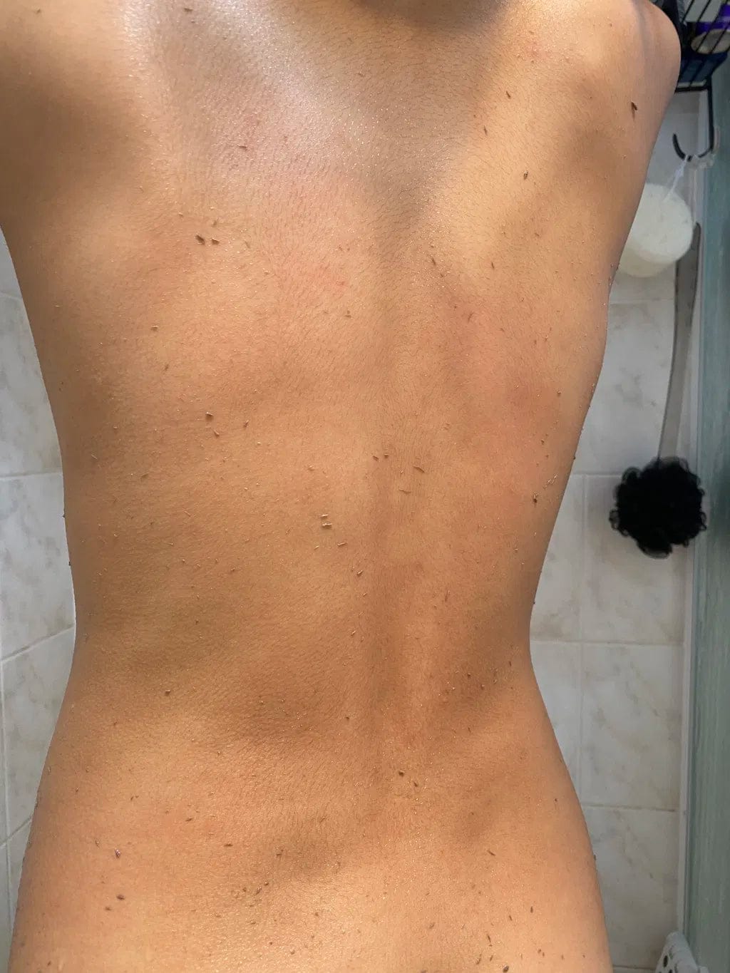 Customer photo review of CLEANBO® ~ Guante Exfoliante Corporal