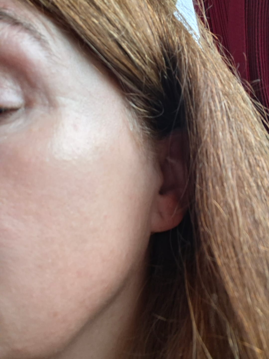 Customer photo review of BIOME Repair Serum