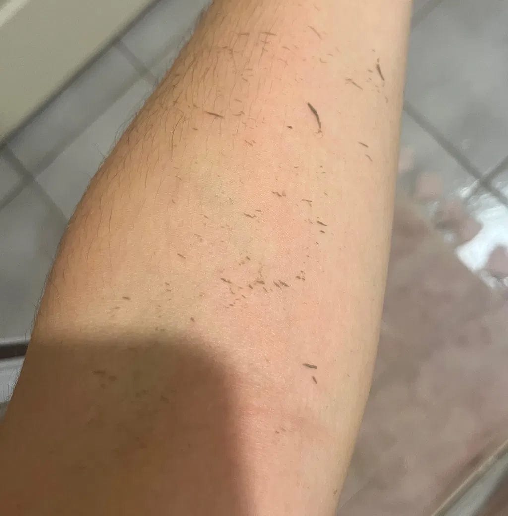 Customer photo review of CLEANBO® ~ Guante Exfoliante Corporal