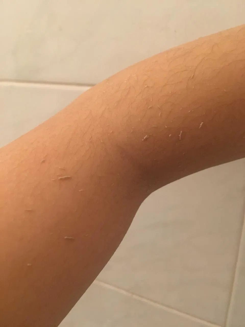 Customer photo review of CLEANBO® ~ Guante Exfoliante Corporal