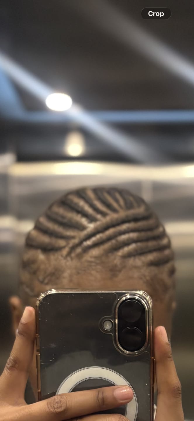 Customer photo review of Minoxidil 5% Solution, 1 x 60ml pack