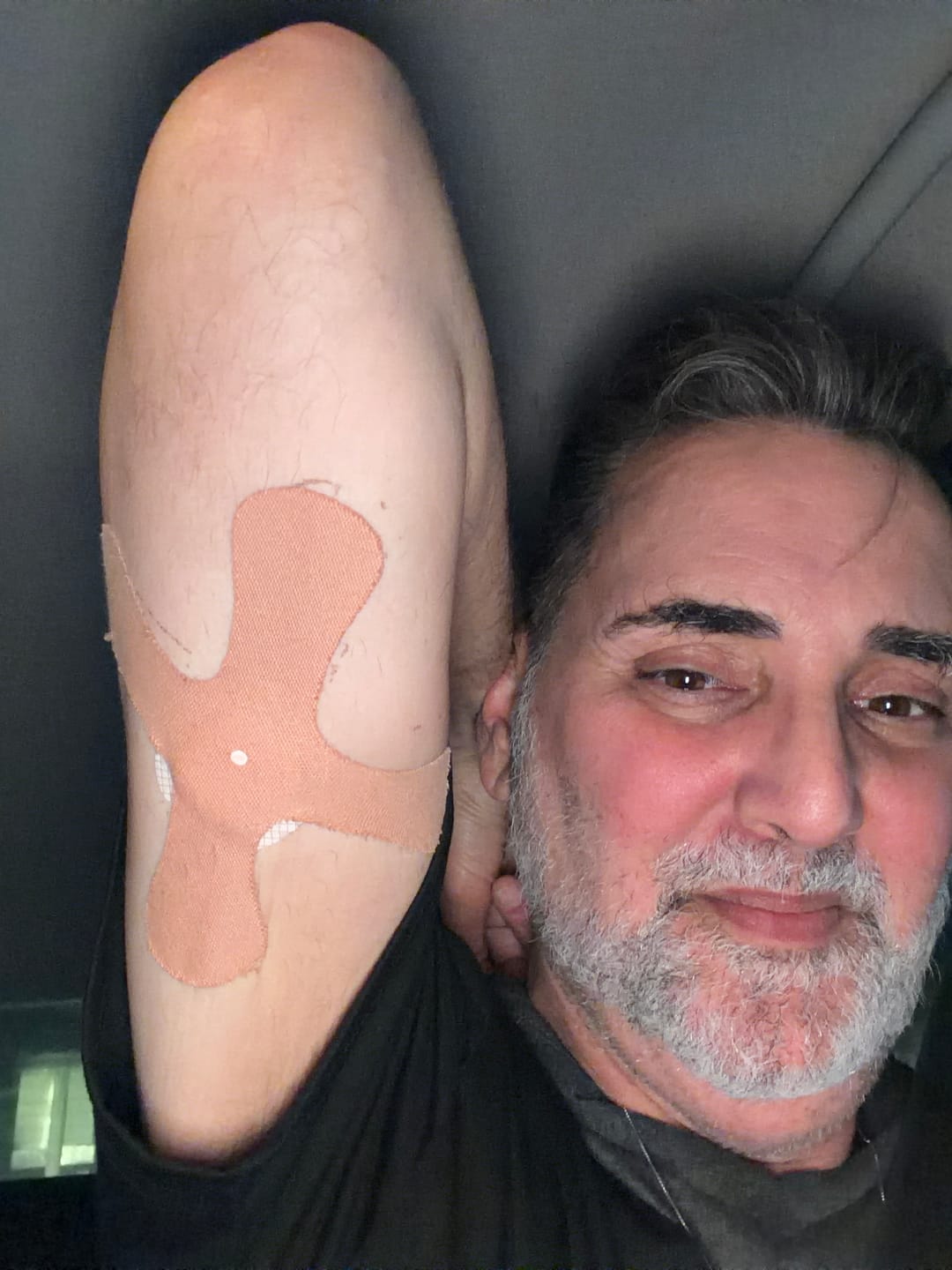 Customer photo review of X- Patch גוף 20 יח׳