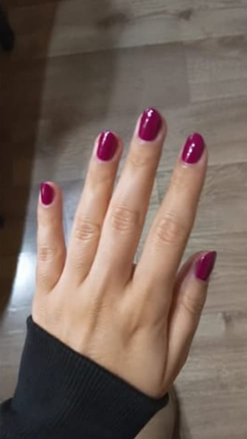 Customer photo review of Lunexor Gel Kit™