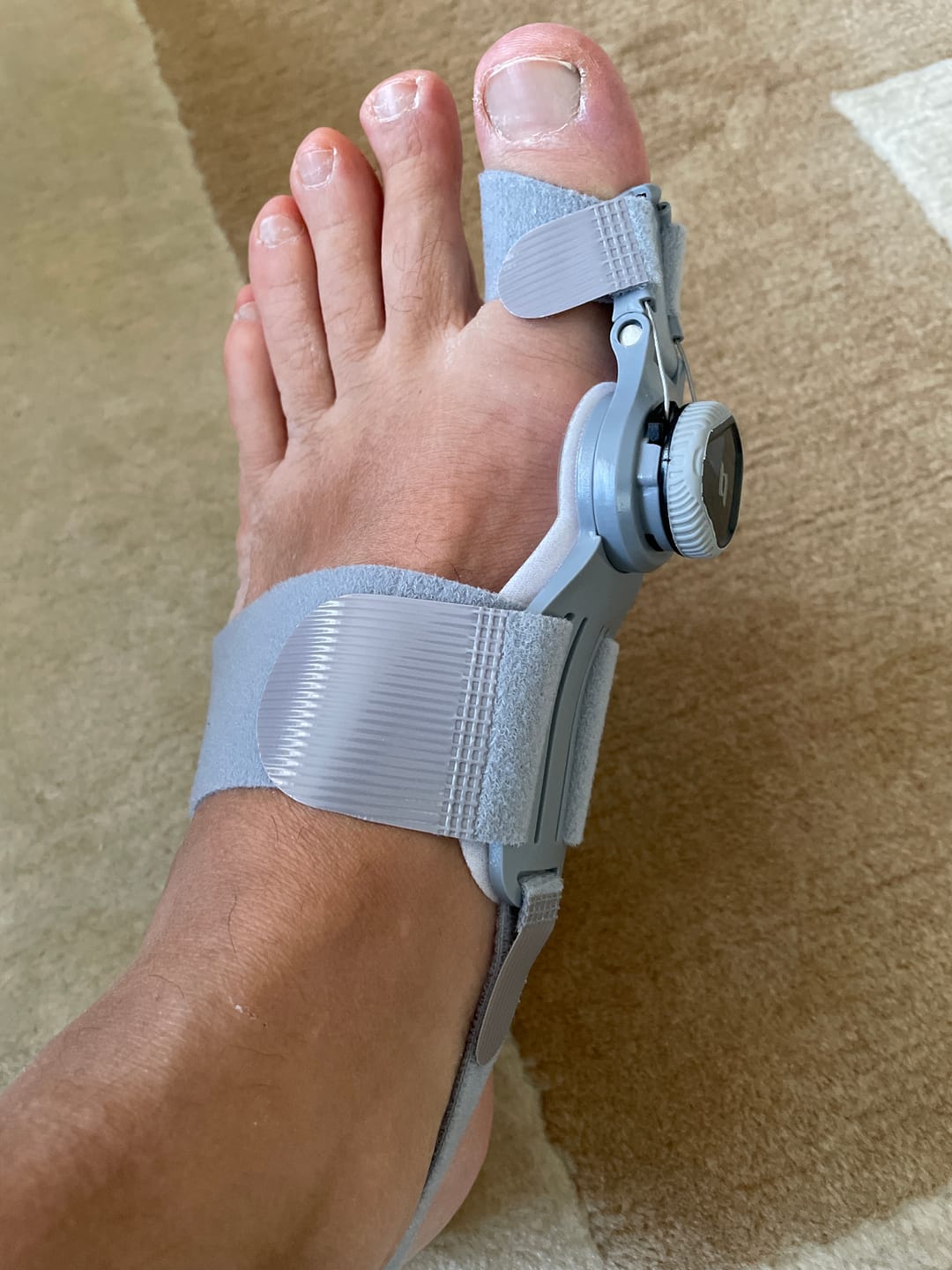 Customer photo review of Foot Medikal™ Ayak Ateli