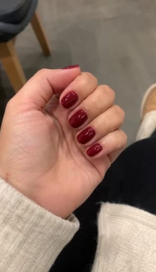 Customer photo review of Lunexor Gel Kit™