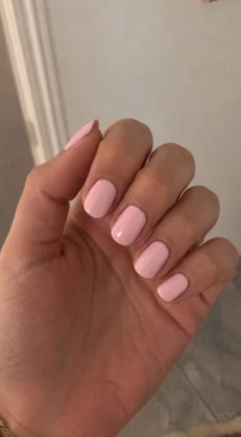 Customer photo review of Lunexor Gel Kit™