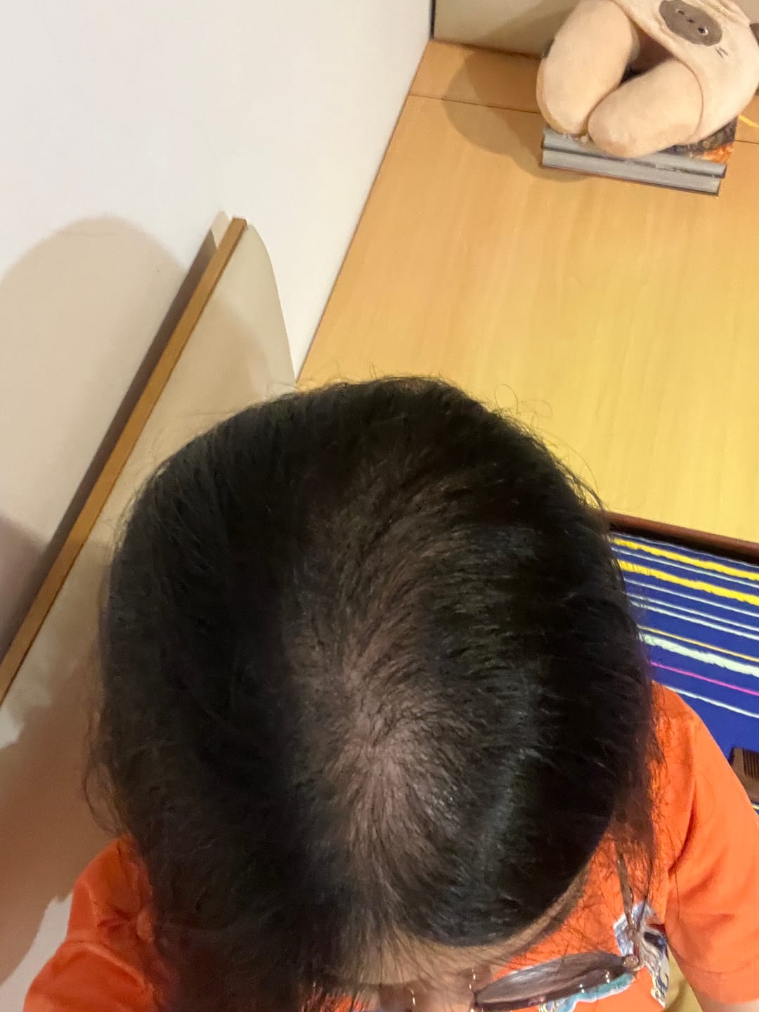 Customer photo review of VITAFOAM ™ Hair Growth Formula