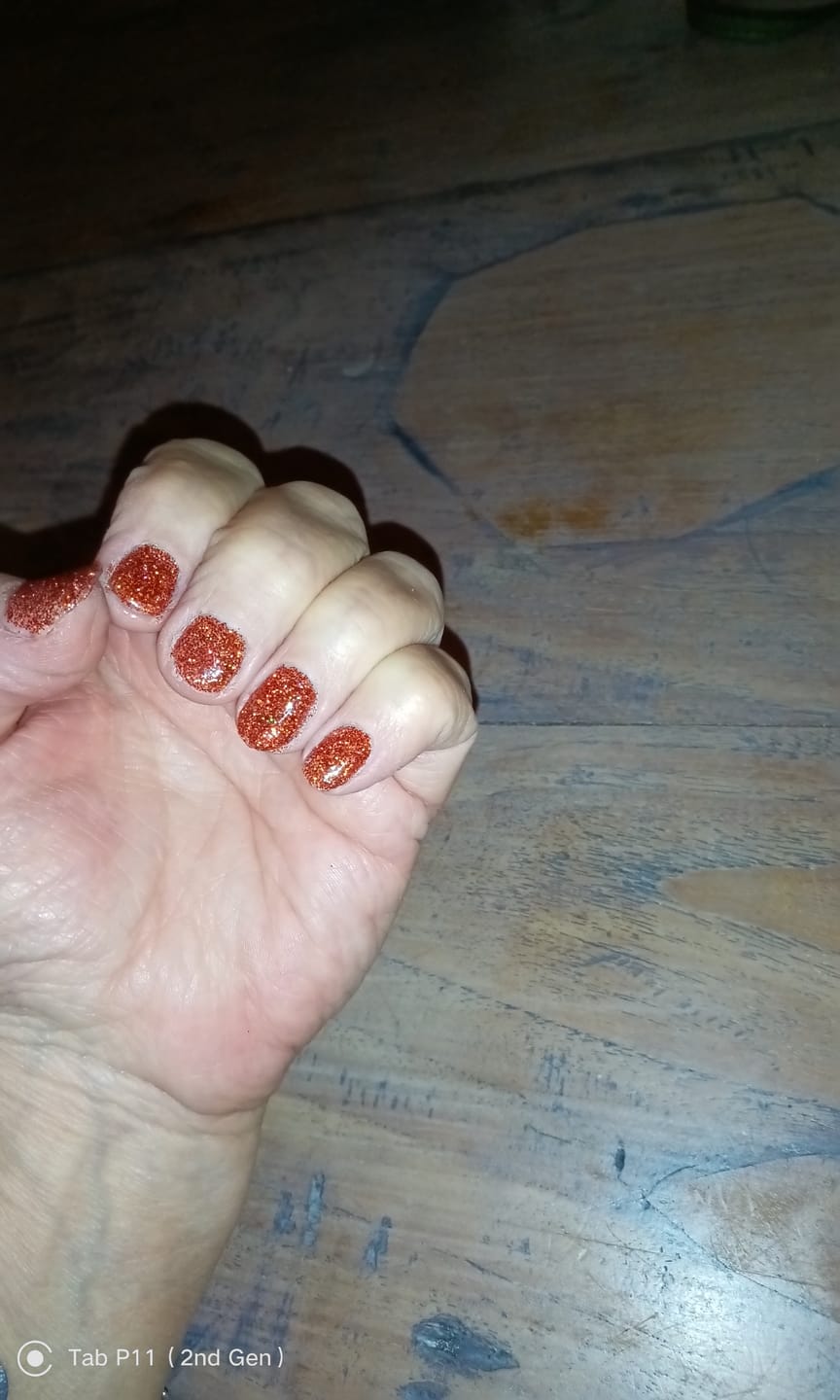 Customer photo review of Verzending Verzekering