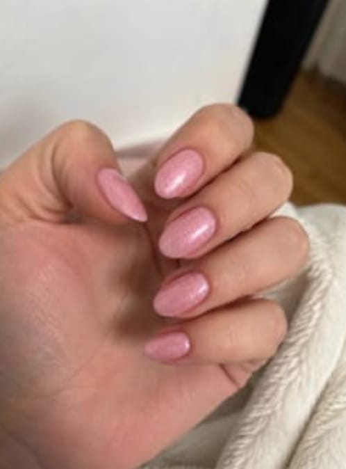 Customer photo review of Lunexor Gel Kit™