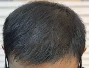 Customer photo review of iPhone 16 pro max