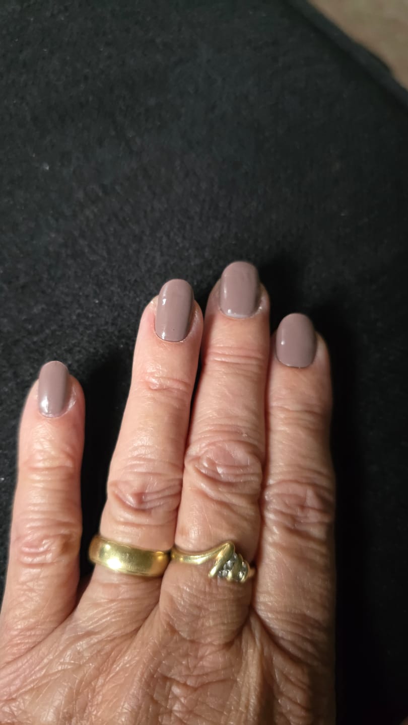 Customer photo review of Verzending Verzekering