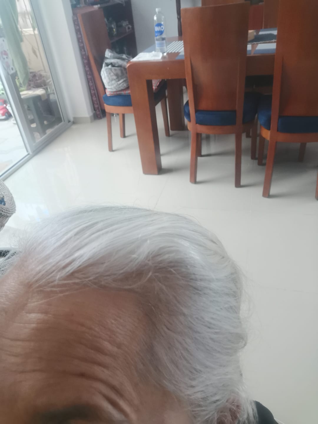 Customer photo review of CAÍDA CAPILAR · Tónico Capilar de Romero