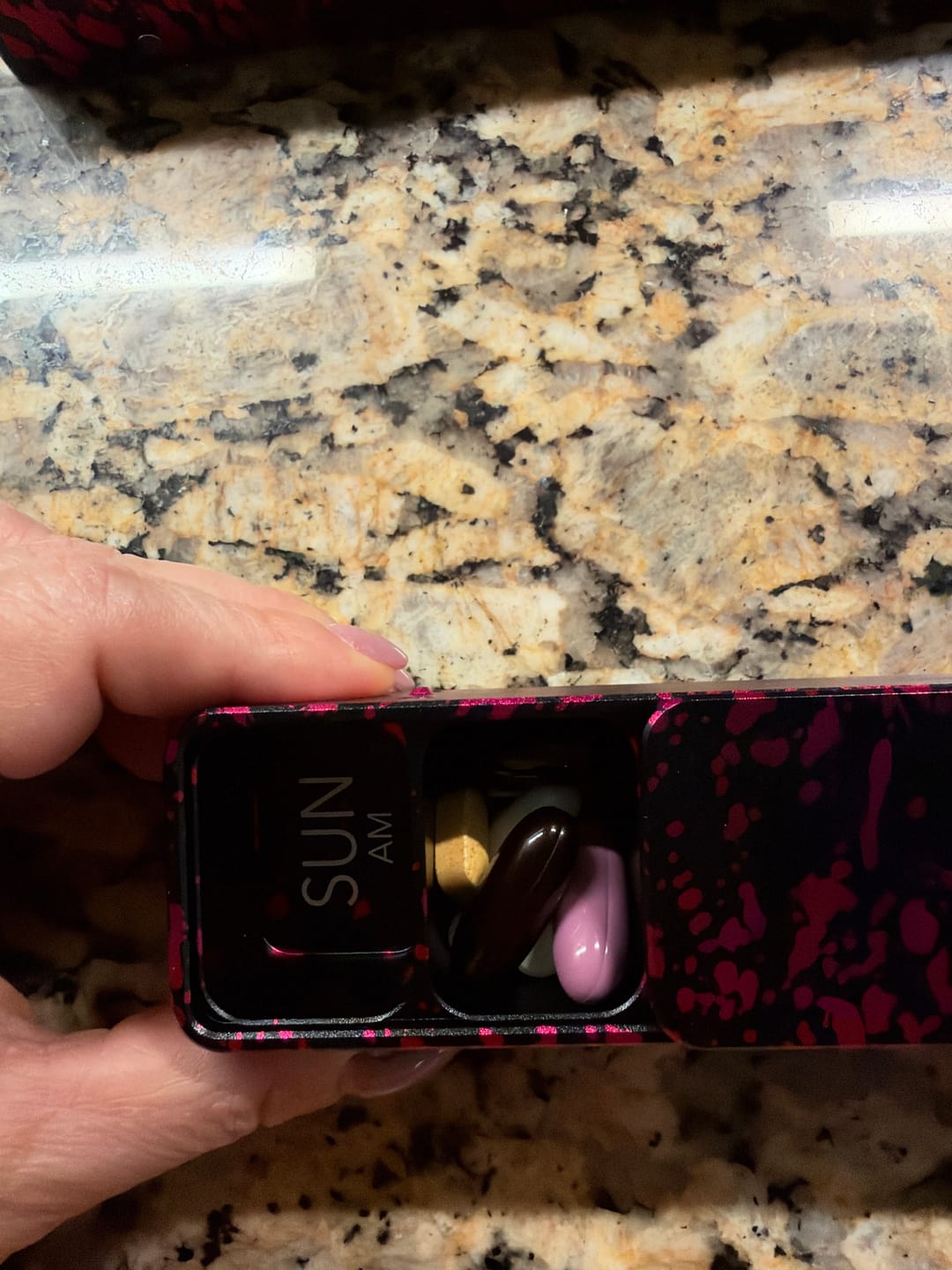 Customer photo review of AM - Left Side