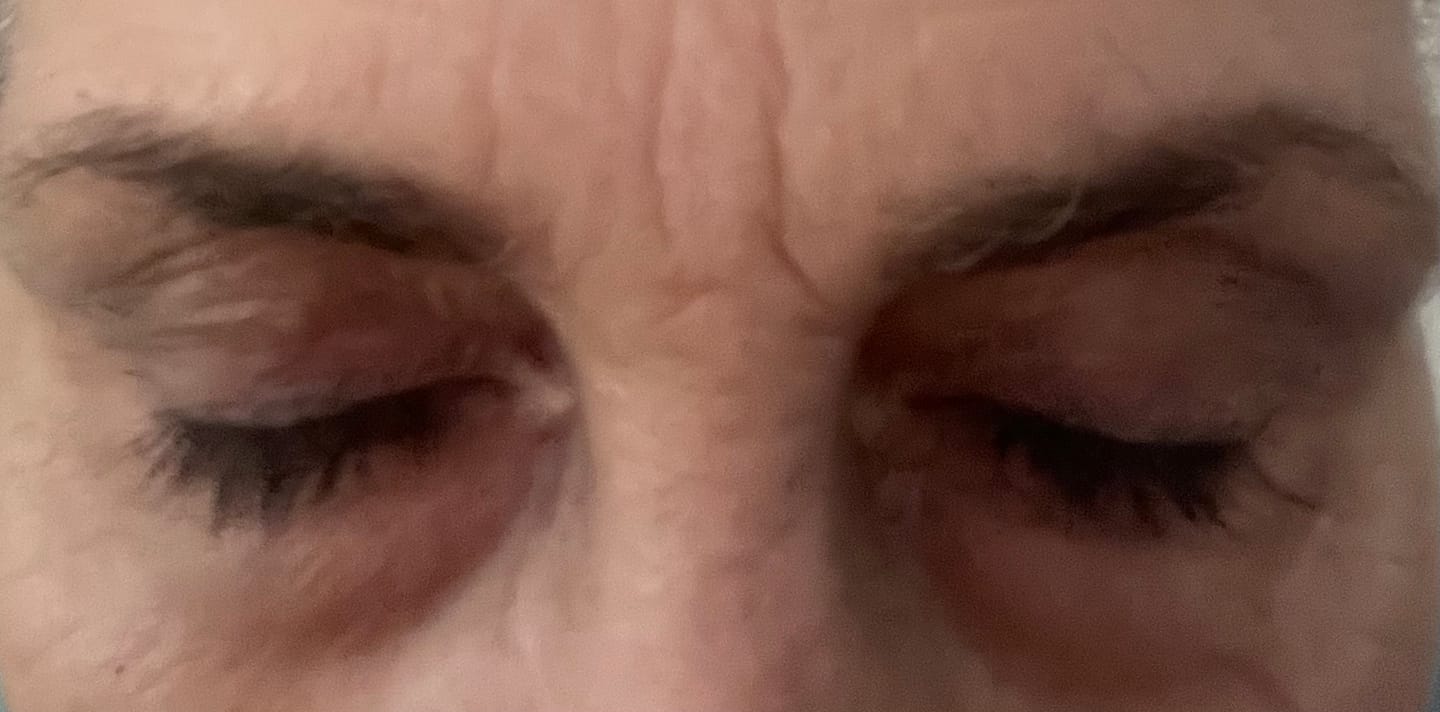 Customer photo review of LASHCOCA!NE - Wimpernserum
