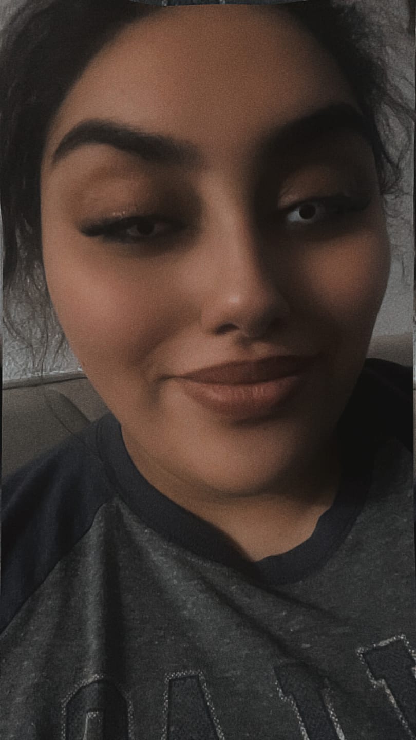 Customer photo review of Halloween Whiteout Prescription Colored Contact Lenses